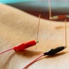 Electroacupuncture Mediates Whole-body Glucose Uptake ElectroAcupuncture copy