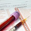 Serum Bilirubin Concentrations and Chronic Kidney Disease blood test
