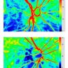 Infrared Light Irradiation on Retinal Artery, Vein Blood Flow & Atherosclerosis-inducing Factors Microsoft Word - 171124 Figure