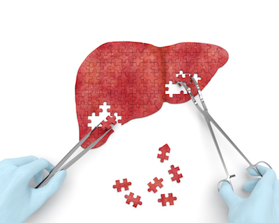 nonalcoholic fatty liver disease and liver health 