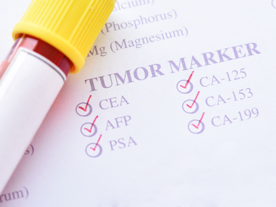 colon cancer inflammasomes