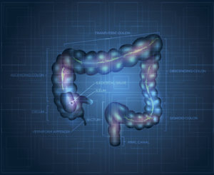 Inflammasomes and colon cancer