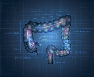 Inflammasomes and colon cancer