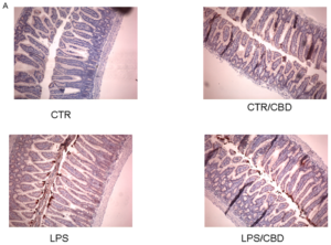 CBD reduces intestinal inflammation 