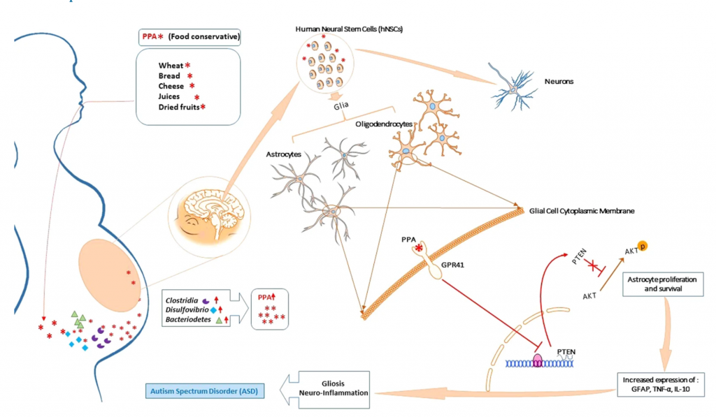 Propionic acid and autism 