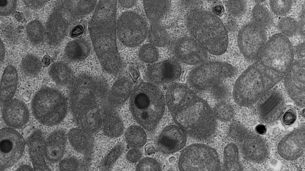 Mitochondrial Myopathy  image Eija Pirinen; A. Wartiovaara's research group