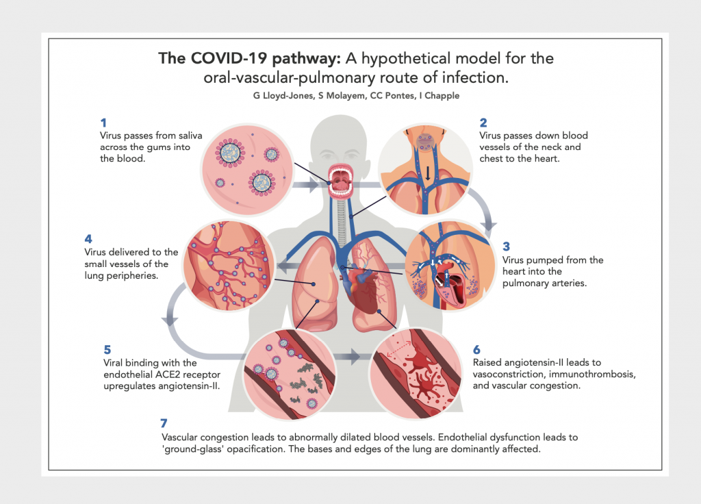 Mouth and Gums as a Transmission Path for COVID-19